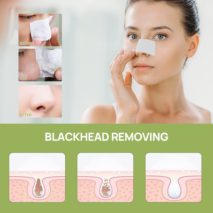 LANBENA Blackhead Mask Pore Strips