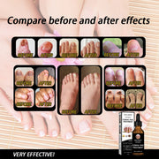 EELHOE Nail Repair Solution