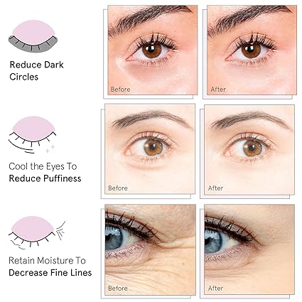 Gold Under Eye Masks – 24 Pairs for Dark Circles, Puffiness, and Wrinkles – Gel Patches, Perfect Gift for Women