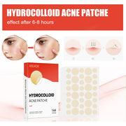 Pimple Patches for Face – 300 Count, 4 Sizes, Hydrocolloid with Salicylic Acid, Tea Tree Oil & Calendula Oil